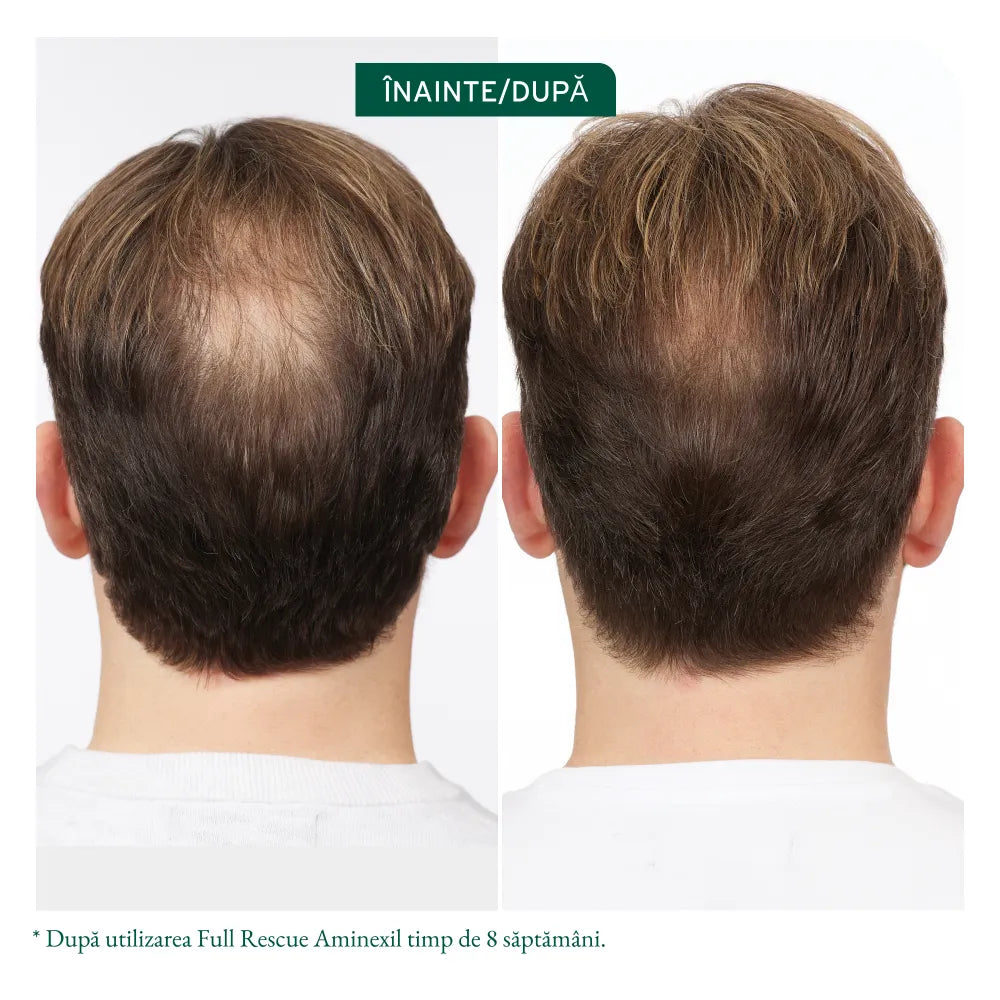 Biolage Full Rescue Tratament Leave-In cu Aminexil Ulei de Rozmarin și Niacinamide – 6x10ml - Păr